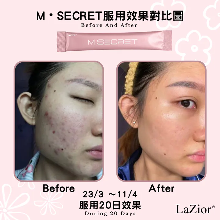 【2折試食最後幾盒】M.Secret 膠原蛋白肽