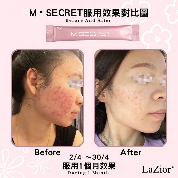【2折試食最後幾盒】M.Secret 膠原蛋白肽