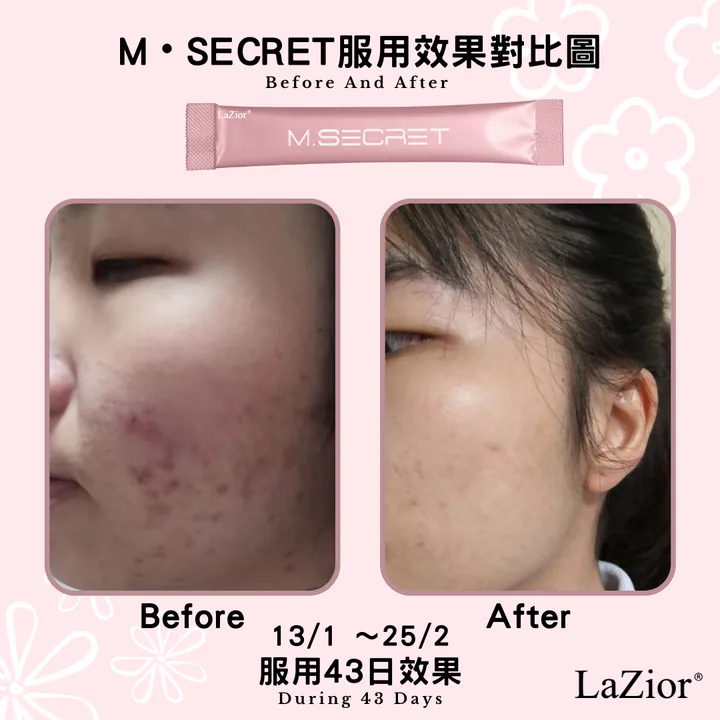 【2折試食最後幾盒】M.Secret 膠原蛋白肽
